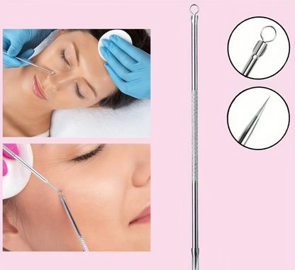Say Goodbye to Blackheads | Stainless Steel Dual-Ended Extractor Tool