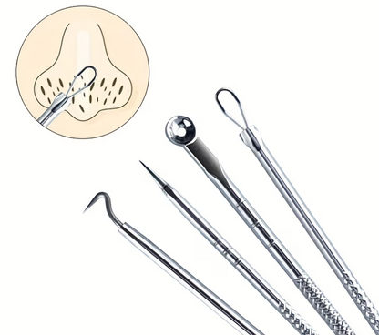 Clear Skin, Zero Excuses | 4pc Professional Blackhead & Pimple Extractor Kit